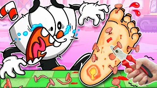 S O S❗ Cuphead Stepped On Nails || How To Athlete's Foot Treatment || Poppy Playtime Animation