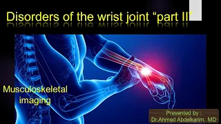 8-Disorders of the wrist "part II"