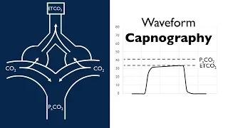 Waveform Capnography -- BAVLS