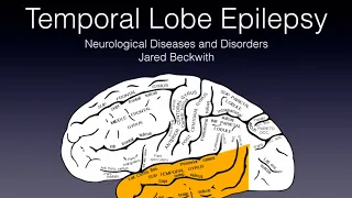 Temporal Lobe Epilepsy 🧠⚡️