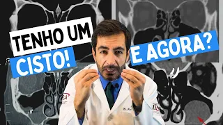 Cisto ou pólipo na tomografia da face: é perigoso?Precisa operar? É sinusite cronica?