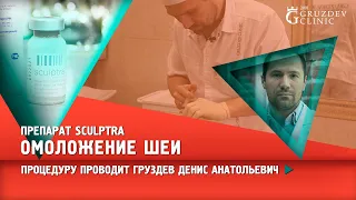 Омоложение шеи с использование препарата Sculptra