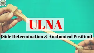 ULNA I Side Determination I Anatomical Position