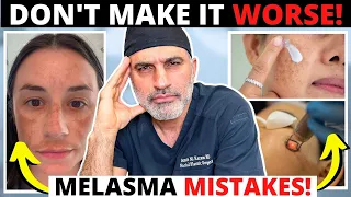 Melasma mistakes that can ruin your skin and make hyperpigmentation worse!