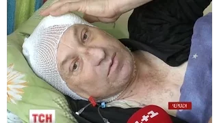 У Черкасах бурулька травмувала 53-річного чоловіка