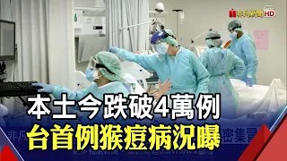 今本土確診39586.死亡134 專家估再一周降至兩位數.. 25歲男"猴痘"病況曝 腿部密集冒痘.皮膚泛紅｜非凡財經新聞｜20220626