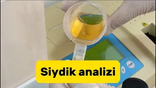 Siydik analizi 🤩