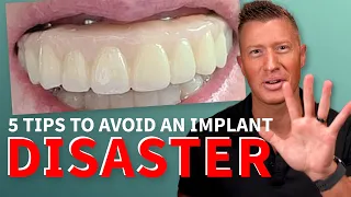 5 Tips to ESCAPE DISASTER with your All-on-4 Smile, All-on-6, Full Mouth Dental Implant Smile