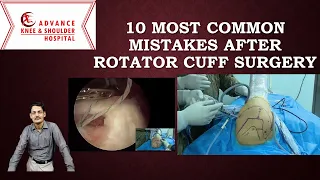 10 Most Common mistakes following Rotator cuff surgery