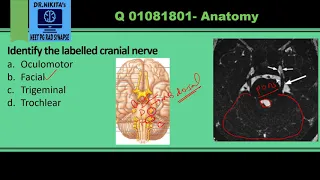 Cranial nerves anatomy and identification- MRI