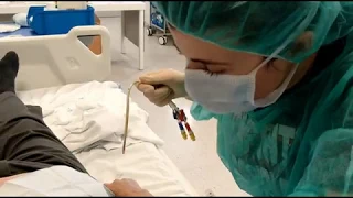 Técnica Astudillo: retirada de catéter venoso central tunelizado para Hemodiálisis