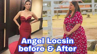 Angel Locsin Before & After Tumaba