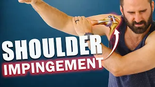 Shoulder Pain. BEST Exercises, Rehab & Stretches for Shoulder Impingement!!