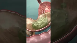 3D fascinante du tractus gastro intestinal humain