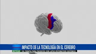 ¿Cómo impactan los videojuegos y la tecnología el cerebro de los niños?