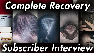 Complete Hair Loss Reversal...He did this: HairStacks Interview No.1