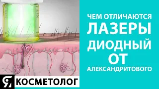 Чем отличаются лазеры – диодный от александритового? Лазерная эпиляция