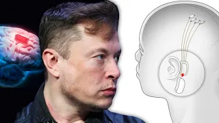 El oscuro secreto de Elon Musk