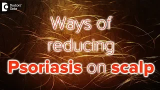 What helps psoriasis on scalp? - Dr. Rasya Dixit