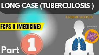 Long Case Tuberculosis for FCPS II (Medicine)#infectiousdiseases #medicine