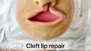 Playdough Surgery 🔪👄 - Cleft Lip Repair