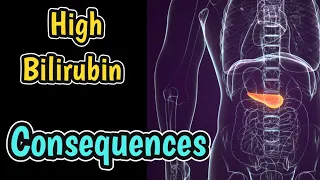 Consequences & Causes Of High Bilirubin | Effects Causes Of High Bilirubin Levels |