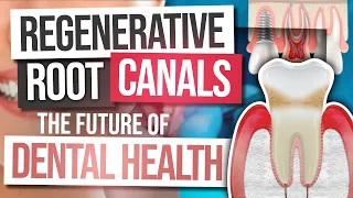 Regenerative Root Canals, the Future Of Dental Care