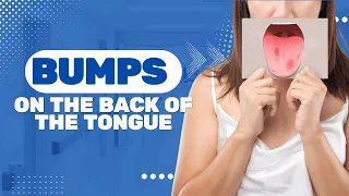 Bumps On The Back Of The Tongue: 5 Symptoms And Rare Causes