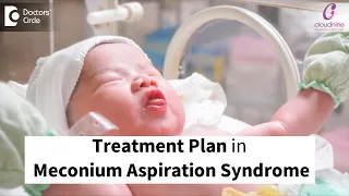 Treatment for Meconium Aspiration Syndrome-Dr.Spoorti Kapate of Cloudnine Hospitals| Doctors' Circle