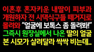 실화사연-이혼후 혼자키운 내딸이 피부과 개원하자 전 시댁식구들 떼거지로 몰려와 "얼굴에 보톡스 좀 돌려봐~" 그즉시 원장실에서 나온 딸의 얼굴 본 시모가 살려달라 싹싹 비는데_썰맘