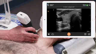 Thyroid - Ultrasound Scanning Technique