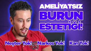 🌸 AMELİYATSIZ BURUN ESTETİĞİ  🌸