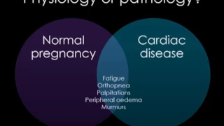 Management of the parturient with cardiac disease