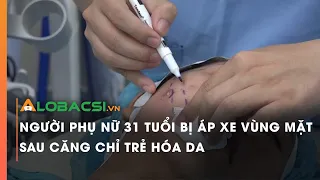 Người phụ nữ 31 tuổi bị áp xe vùng mặt sau căng chỉ trẻ hóa da