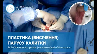 Парус калитки: пластика (висічення) парусу калитки / Парус мошонки / Plastic of sail of the scrotum