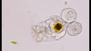 Rotifer can't quite swallow euglenoid and finally gives up!