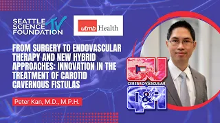 Surgery to Endovascular Therapy, New Hybrid Approaches: Carotid Cavernous Fistulas - Peter Kan, M.D.