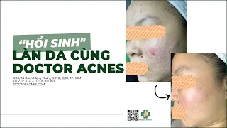 DOCTOR ACNES - “HỒI SINH” LÀN DA CÙNG DOCTOR ACNES