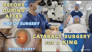 DAY OF CATARACT SURGERY Uncensored | Join me BEFORE, DURING, and AFTER Surgery