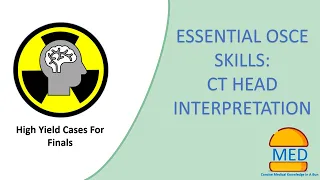 ESSENTIAL OSCE SKILLS: CT HEAD INTERPRETATION with high yield examples