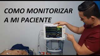 Como monitorizar a un paciente