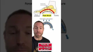 La verdad sobre el soporte del arco