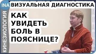 Как увидеть боль в пояснице? Визуальная диагностика. Васильева кинезиология