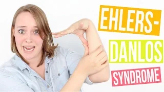 MY EHLERS-DANLOS SYNDROME DIAGNOSIS STORY.