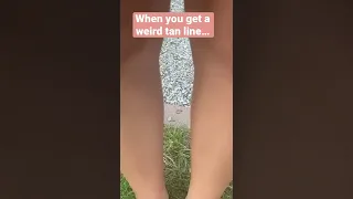 When You Get A Weird Tan Line…