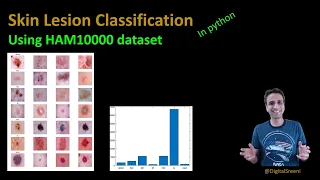 203 - Skin cancer lesion classification using the HAM10000 dataset