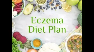 What Food to Eat For Eczema | Eczema Diet Plan | Dermatitis