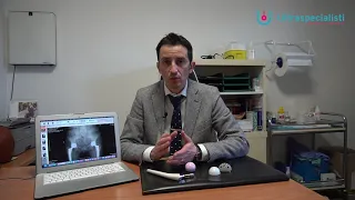 Dolore dopo la Protesi dell'Anca | Dr. Alessio Biazzo