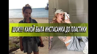 ШОК!!!! Какой была Инстасамка до пластики.