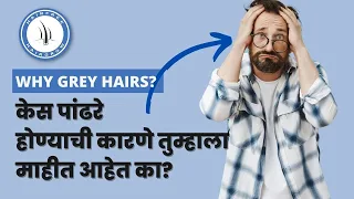 Causes of White Hairs | Grey Hairs | केस पांढरे होण्याची कारणे तुम्हाला माहीत आहेत का? | Marathi